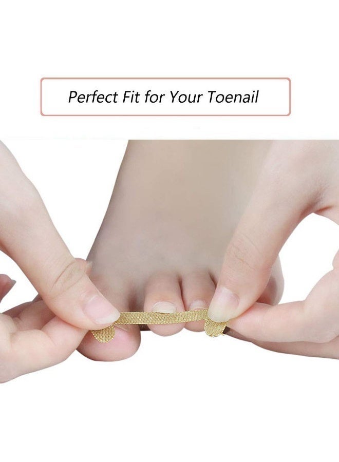 Peachjoy 20 PCS Ingrown Toenail Correction Stickers, Glue-free Ingrown Toenail Corrector Strips, Painless Pedicure Toenail Corrector Patch Professional Toenail Treatment Tool Foot Care - Image 2